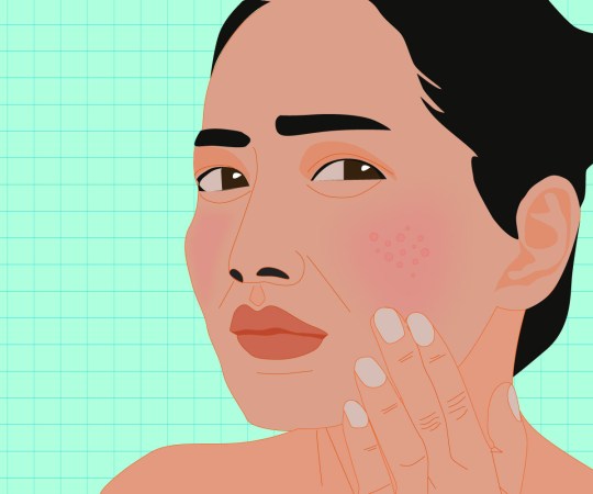 Your Skin Might Be Irritated and You Don’t Even Know It